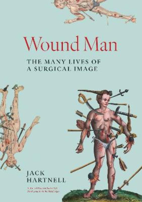 Wound Man by Jack Hartnell - 9780691243481